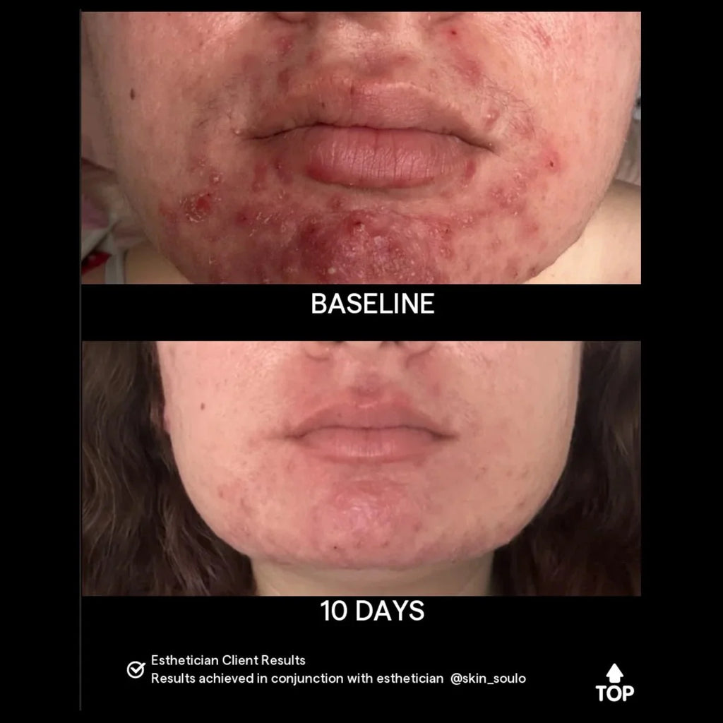 SIV | biome balancing serum